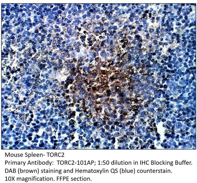 TORC2 Antibody in Immunohistochemistry (Paraffin) (IHC (P))