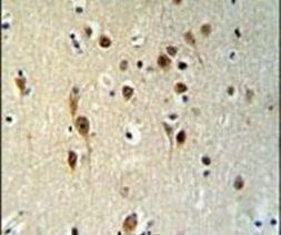 TOX3 Antibody in Immunohistochemistry (IHC)