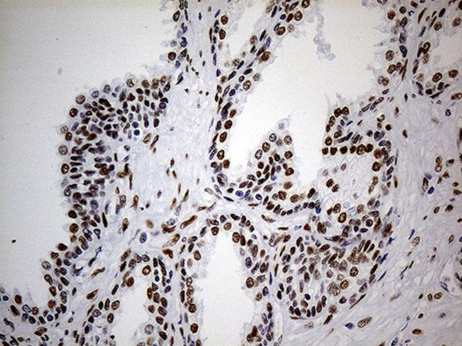 TP53BP1 Antibody in Immunohistochemistry (Paraffin) (IHC (P))