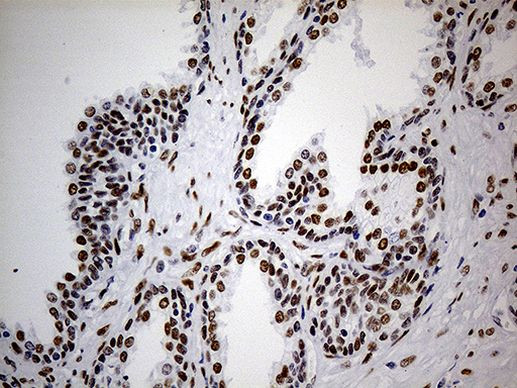 TP53BP1 Antibody in Immunohistochemistry (Paraffin) (IHC (P))