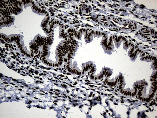 TP53BP1 Antibody in Immunohistochemistry (Paraffin) (IHC (P))