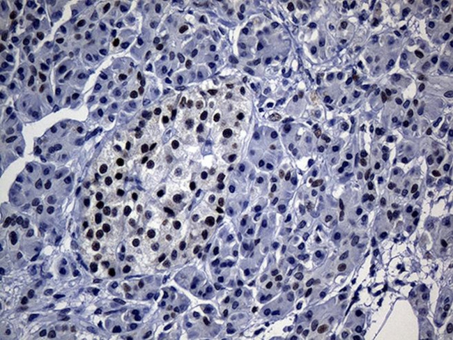 TP53BP1 Antibody in Immunohistochemistry (Paraffin) (IHC (P))