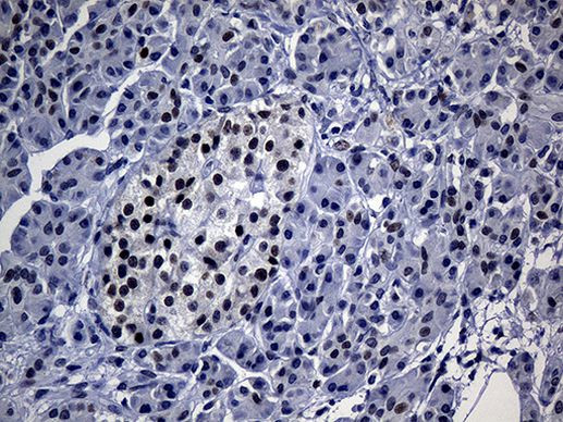 TP53BP1 Antibody in Immunohistochemistry (Paraffin) (IHC (P))