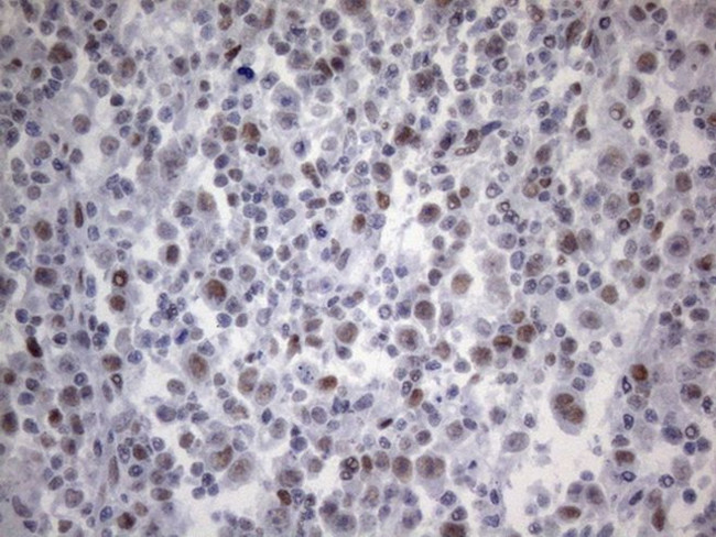 TP53BP1 Antibody in Immunohistochemistry (Paraffin) (IHC (P))