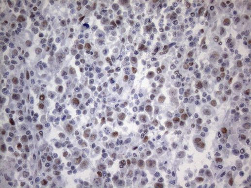 TP53BP1 Antibody in Immunohistochemistry (Paraffin) (IHC (P))