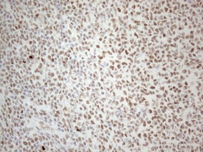 TP53BP1 Antibody in Immunohistochemistry (Paraffin) (IHC (P))