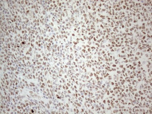 TP53BP1 Antibody in Immunohistochemistry (Paraffin) (IHC (P))