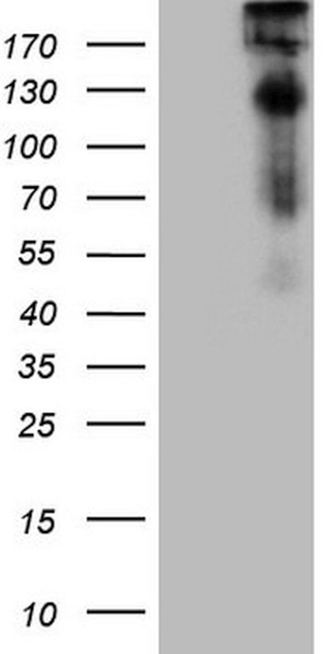 TP53BP1 Antibody in Western Blot (WB)
