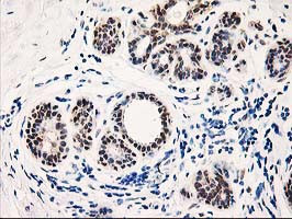 TP53I3 Antibody in Immunohistochemistry (Paraffin) (IHC (P))