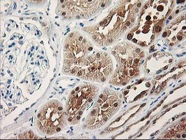 TP53I3 Antibody in Immunohistochemistry (Paraffin) (IHC (P))