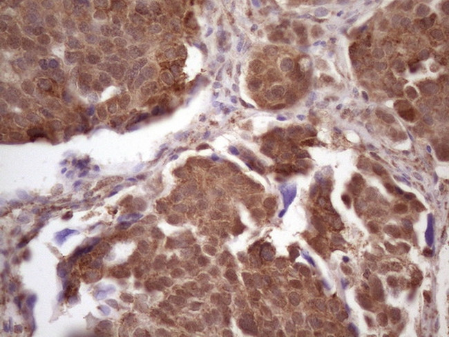 TP53RK Antibody in Immunohistochemistry (Paraffin) (IHC (P))