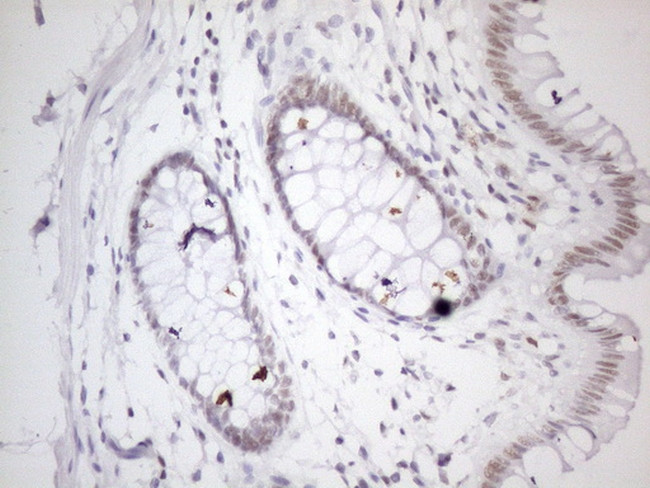 TP53RK Antibody in Immunohistochemistry (Paraffin) (IHC (P))