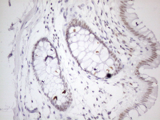 TP53RK Antibody in Immunohistochemistry (Paraffin) (IHC (P))