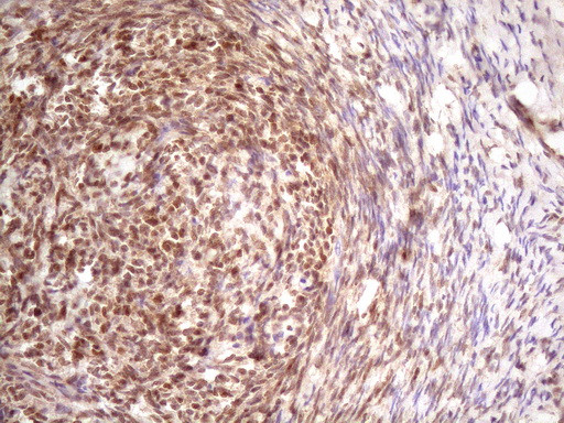 TP53RK Antibody in Immunohistochemistry (Paraffin) (IHC (P))