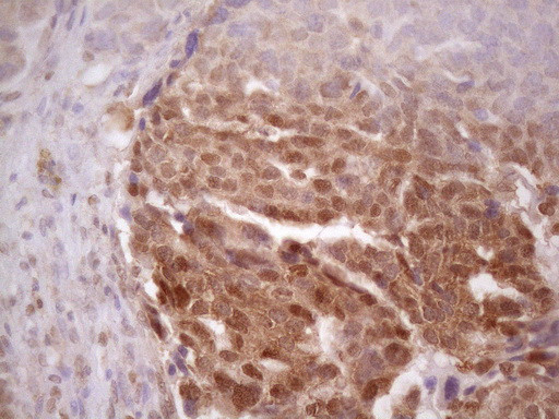 TP53RK Antibody in Immunohistochemistry (Paraffin) (IHC (P))