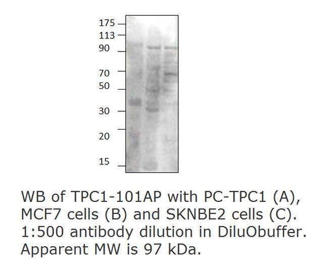 TPCN1 Antibody in Western Blot (WB)