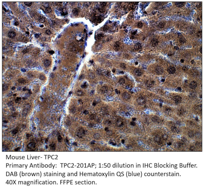 TPCN2 Antibody in Immunohistochemistry (IHC)