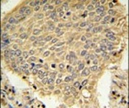 TRAPPC6A Antibody in Immunohistochemistry (IHC)