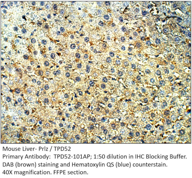 Prlz/TPD52 Antibody in Immunohistochemistry (IHC)