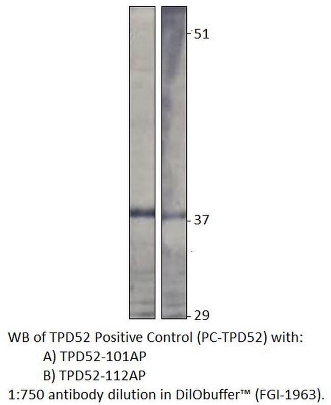 Prlz/TPD52 Antibody in Western Blot (WB)