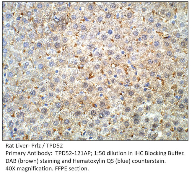 Prlz/TPD52 Antibody in Immunohistochemistry (IHC)