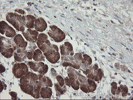 TPD52L3 Antibody in Immunohistochemistry (Paraffin) (IHC (P))