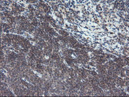 TPD52L3 Antibody in Immunohistochemistry (Paraffin) (IHC (P))