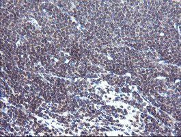 TPD52L3 Antibody in Immunohistochemistry (Paraffin) (IHC (P))