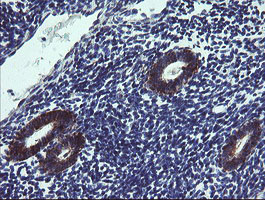 TPD52L3 Antibody in Immunohistochemistry (Paraffin) (IHC (P))