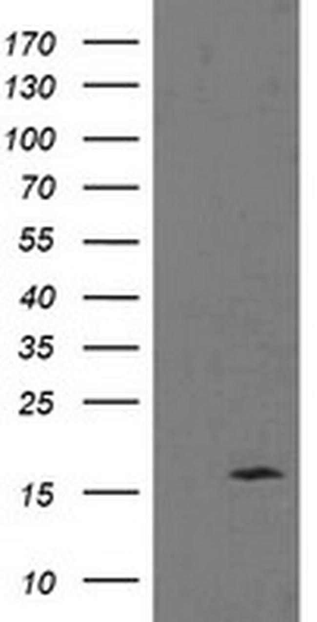 TPD52L3 Antibody in Western Blot (WB)
