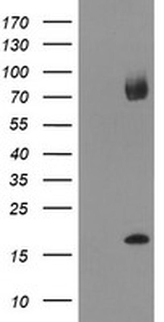 TPD52L3 Antibody in Western Blot (WB)