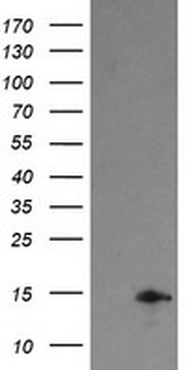 TPD52L3 Antibody in Western Blot (WB)