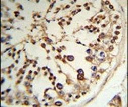 TPK1 Antibody in Immunohistochemistry (IHC)