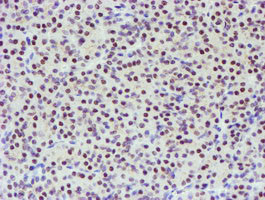 TPRKB Antibody in Immunohistochemistry (Paraffin) (IHC (P))