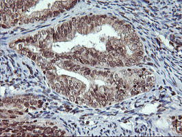 TPSG1 Antibody in Immunohistochemistry (Paraffin) (IHC (P))