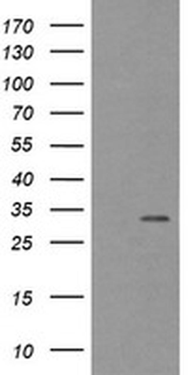 TPSG1 Antibody in Western Blot (WB)