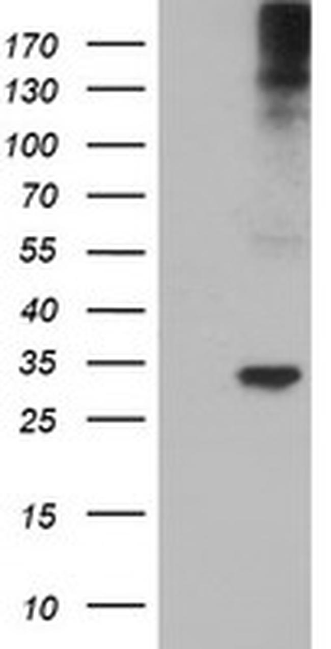 TPSG1 Antibody in Western Blot (WB)