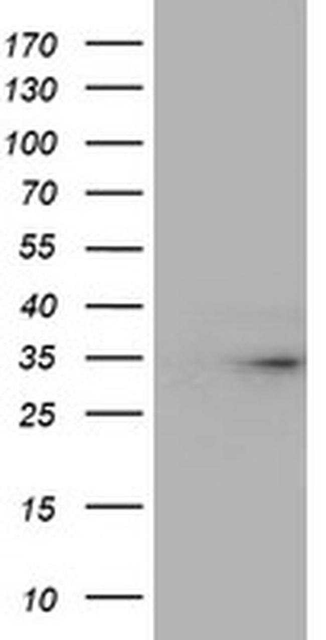 TPSG1 Antibody in Western Blot (WB)