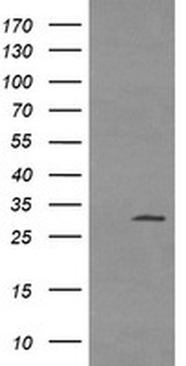 TPSG1 Antibody in Western Blot (WB)