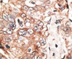 TPX2 Antibody in Immunohistochemistry (IHC)