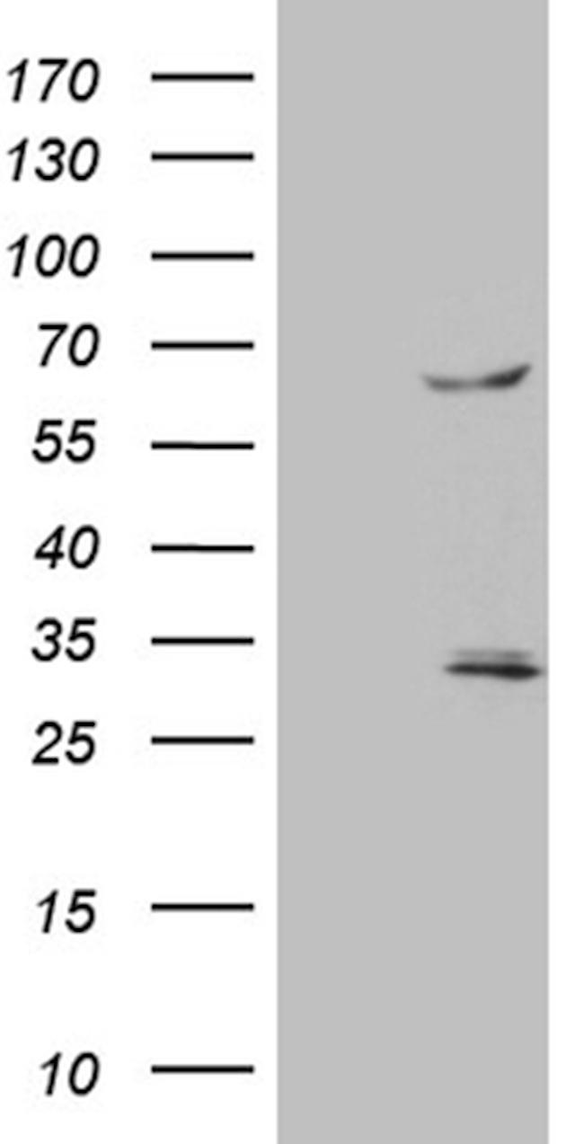 TRAF5 Antibody in Western Blot (WB)