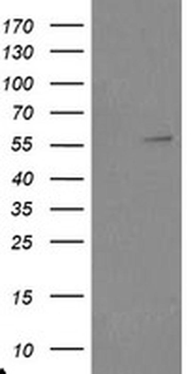 TRAIP Antibody in Western Blot (WB)