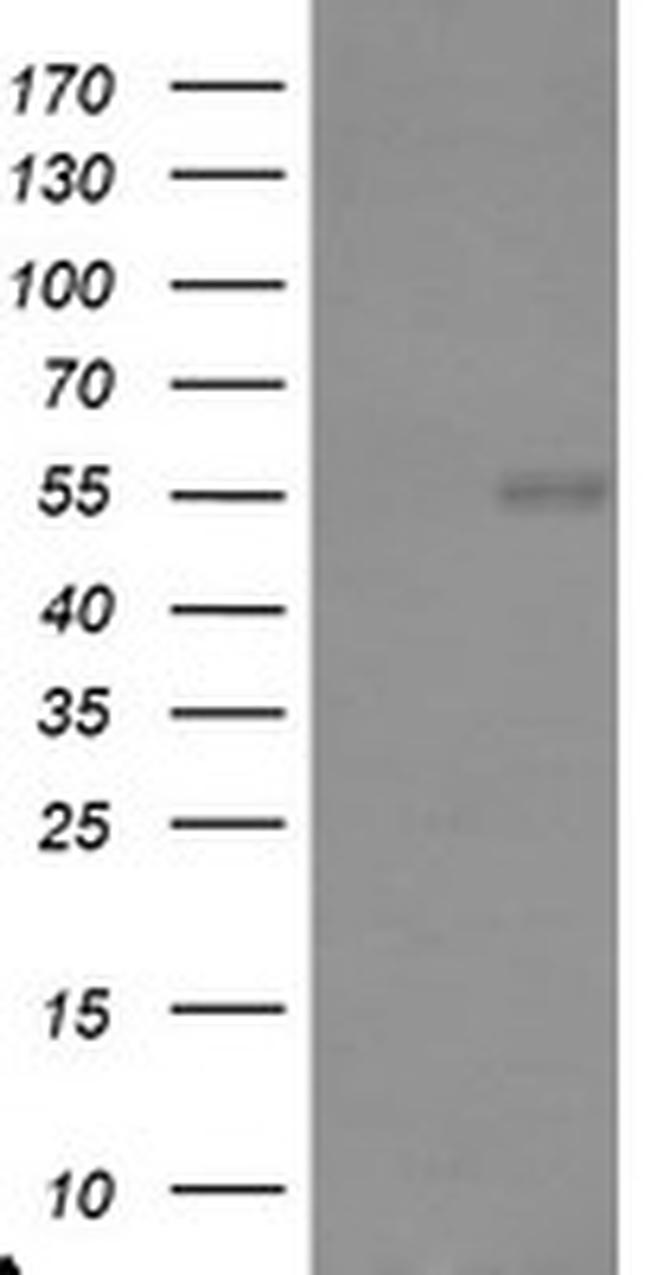 TRAIP Antibody in Western Blot (WB)