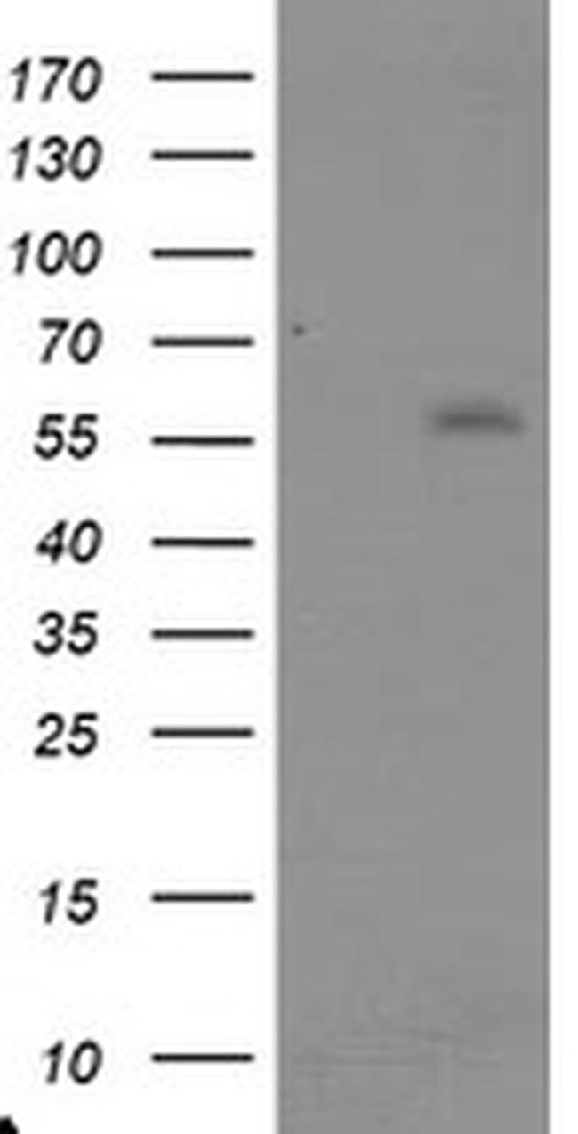 TRAIP Antibody in Western Blot (WB)