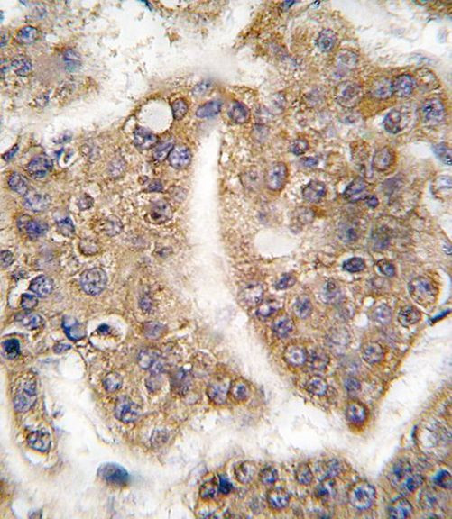 TRIP Antibody in Immunohistochemistry (IHC)