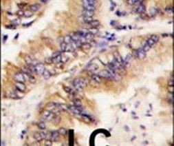 TRAPPC4 Antibody in Immunohistochemistry (IHC)