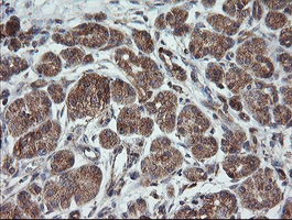 TRAPPC4 Antibody in Immunohistochemistry (Paraffin) (IHC (P))