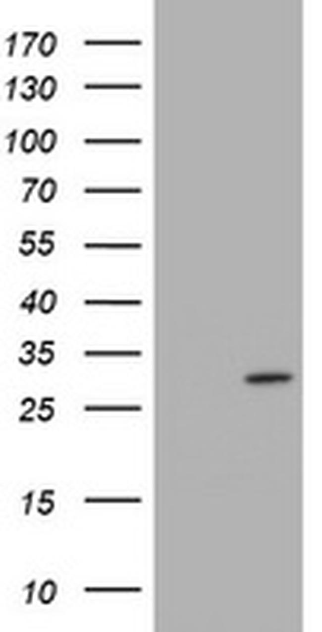 TRAPPC4 Antibody in Western Blot (WB)