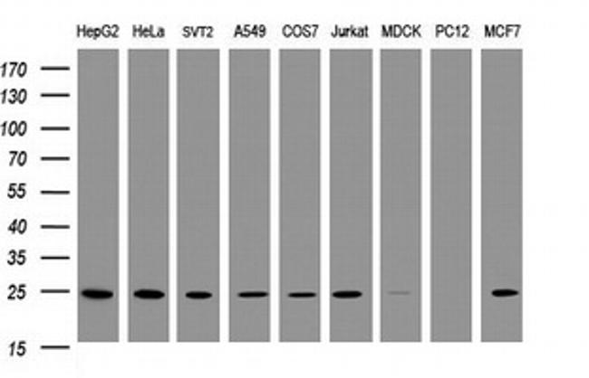TRAPPC4 Antibody in Western Blot (WB)