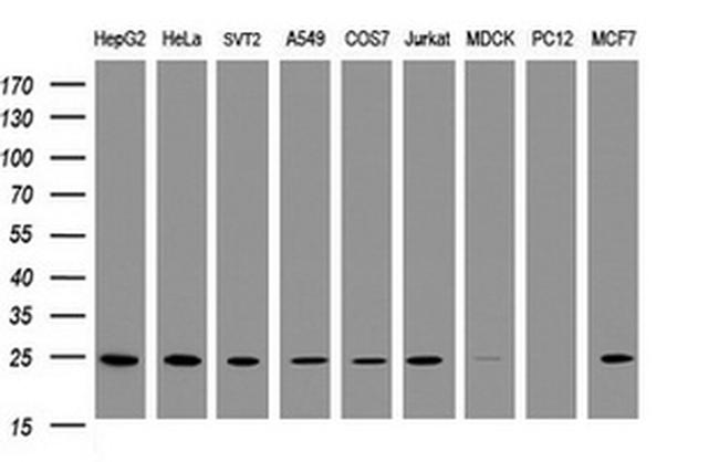 TRAPPC4 Antibody in Western Blot (WB)